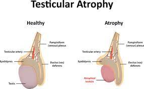 what is testicular atrophy