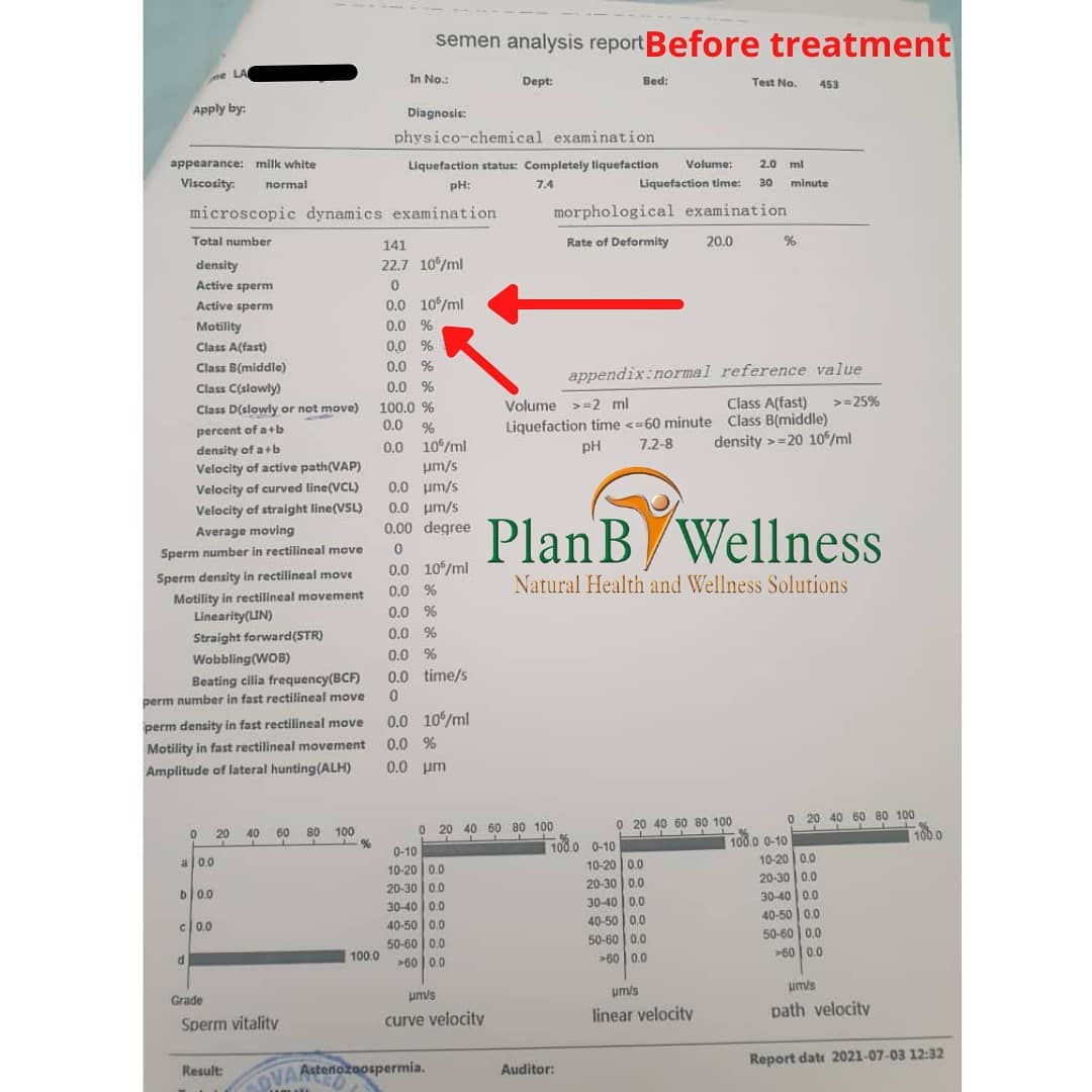Azoospermia treatment testimony in Nigeria by Plan B Wellness (before)