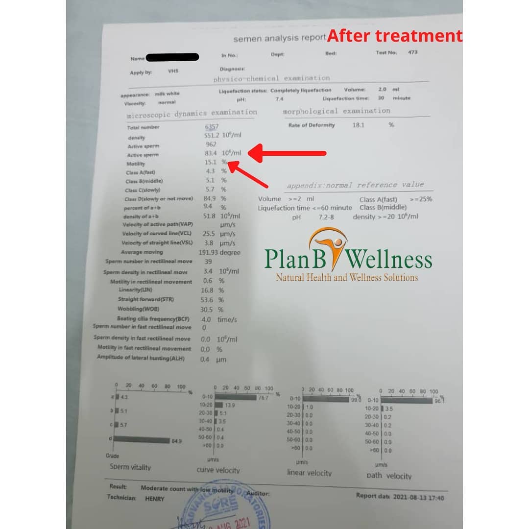 Azoospermia treatment testimony in Nigeria by Plan B Wellness (after)