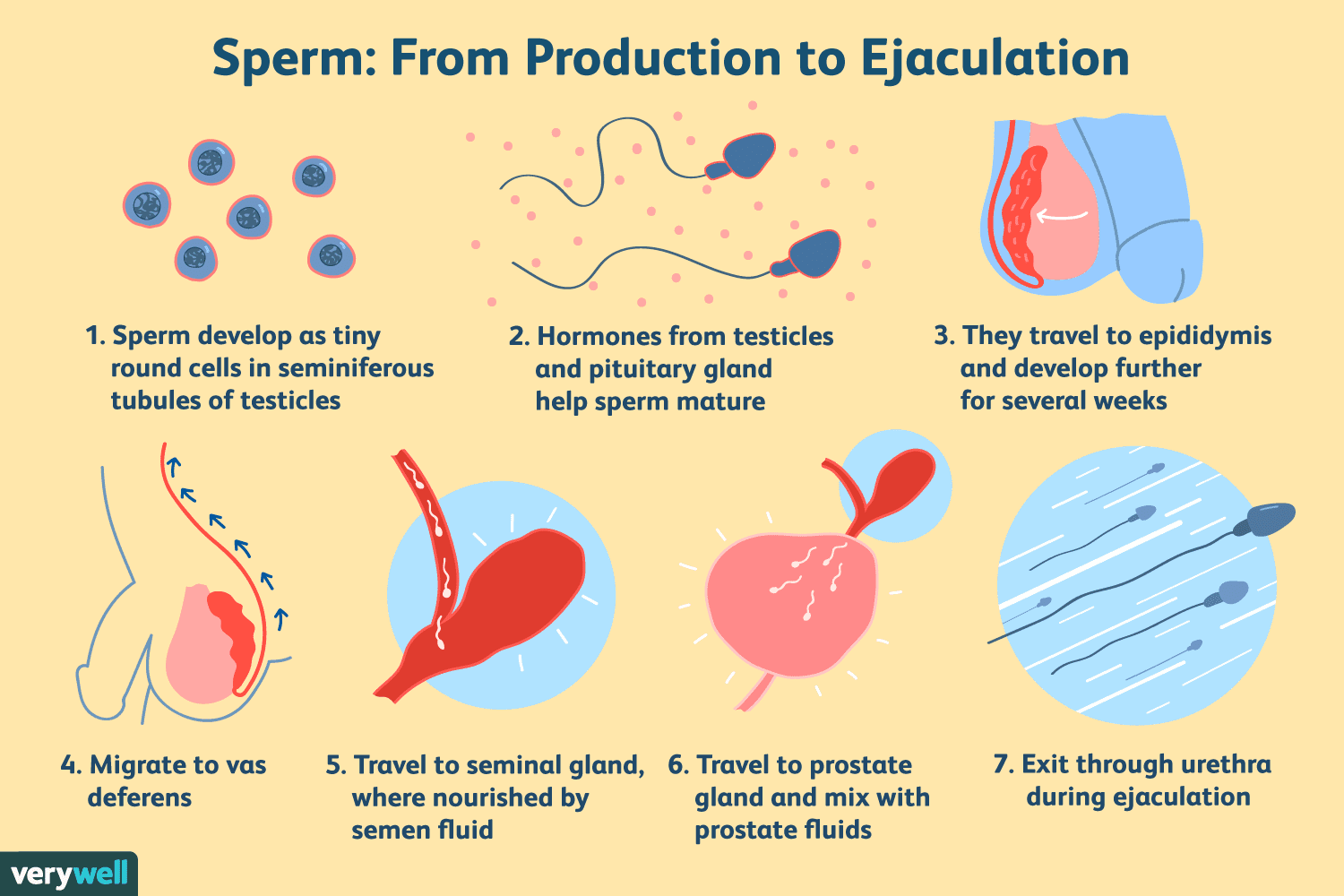 azoospermia overview- sperm production