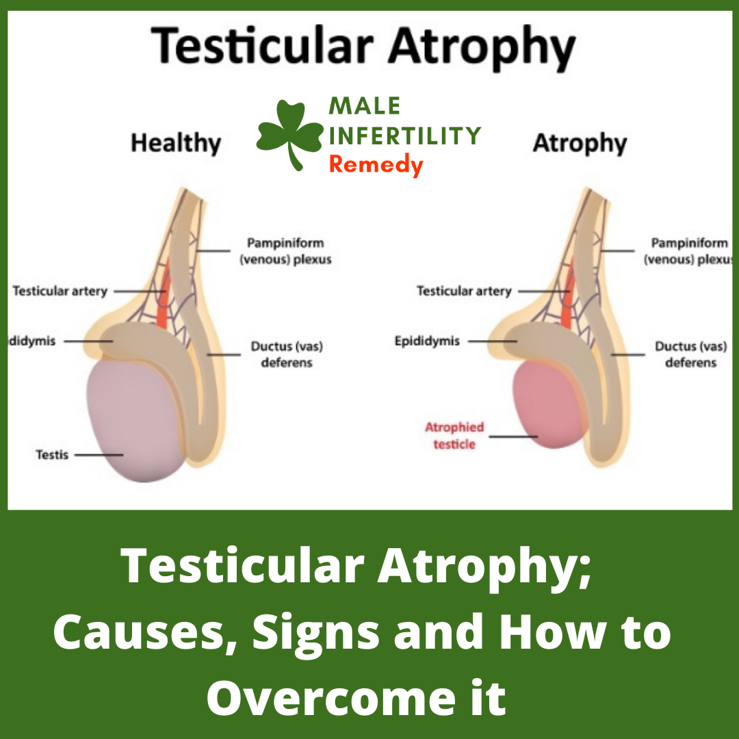 Testicular Atrophy; Causes, Signs and How to Overcome it.